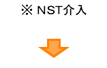 NST介入