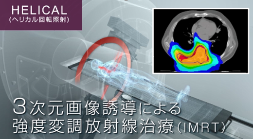 ヘリカル回転照射による放射線治療の図